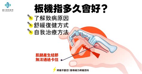 手指腫脹無法彎曲|板機指多久會好？了解板機指原因、舒緩復健方式及自我治療方法